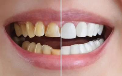 “Cosmetic Dentistry: Transform Your Smile with Modern Techniques”