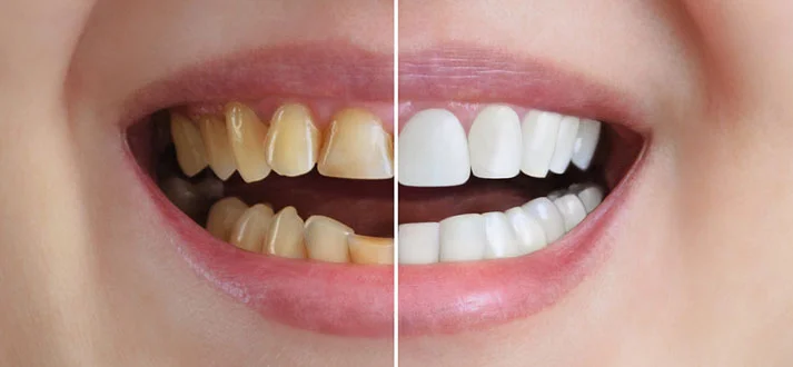 “Cosmetic Dentistry: Transform Your Smile with Modern Techniques”