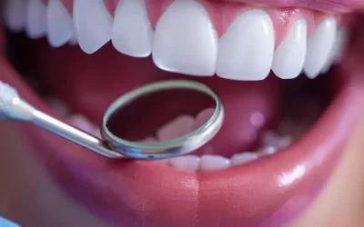 “10 Common Dental Myths Debunked by Experts”