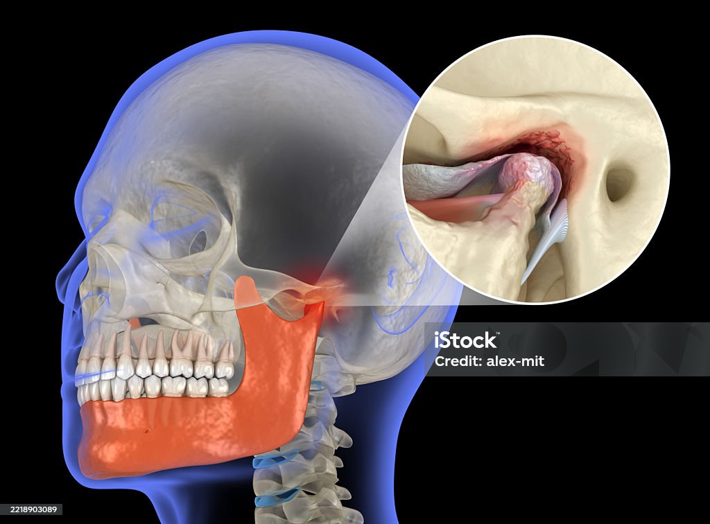 TMJ-TREATMENT-PUNE TMJ Treatment Pune | Jaw Pain & TMJ Disorder Care
