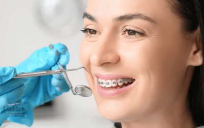 Step-by-Step Guide to Getting Dental Implants in Warje & KothrudBraces & Orthodontics