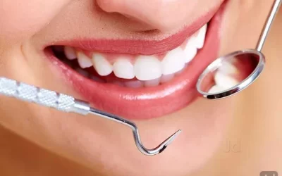 Full Mouth Rehabilitation: How We Restore Smiles for Patients in Kothrud & Karve Nagar