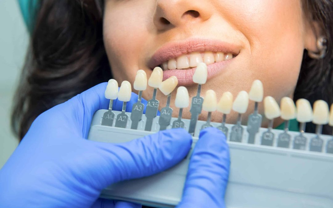 Top 10 Questions About Cosmetic Dentistry – Answered by Our Pune Dentists