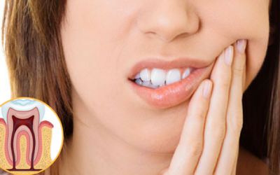 Root Canal Treatments in Karve Nagar: Pain Myths vs. Reality