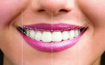 Dental Tourism in Pune: How NRIs Can Plan TMJ, FMR, and Smile Makeover Treatments in One Trip