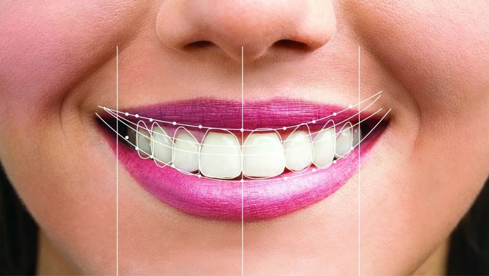 Dental Tourism in Pune: How NRIs Can Plan TMJ, FMR, and Smile Makeover Treatments in One Trip